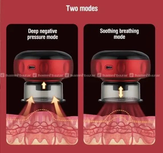MDHL Breathing Cupping Massage Instrument 2